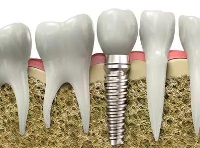 product-402-299